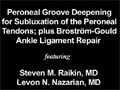 Ankle Ligament Repair