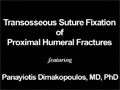 Humeral Fracture | Leg Injury