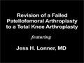 Total Knee Athroplasty | Knee Injury