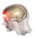 Oregon Brain Injury Lawyers - Dwyer Williams Cherkoss Attorneys, PC